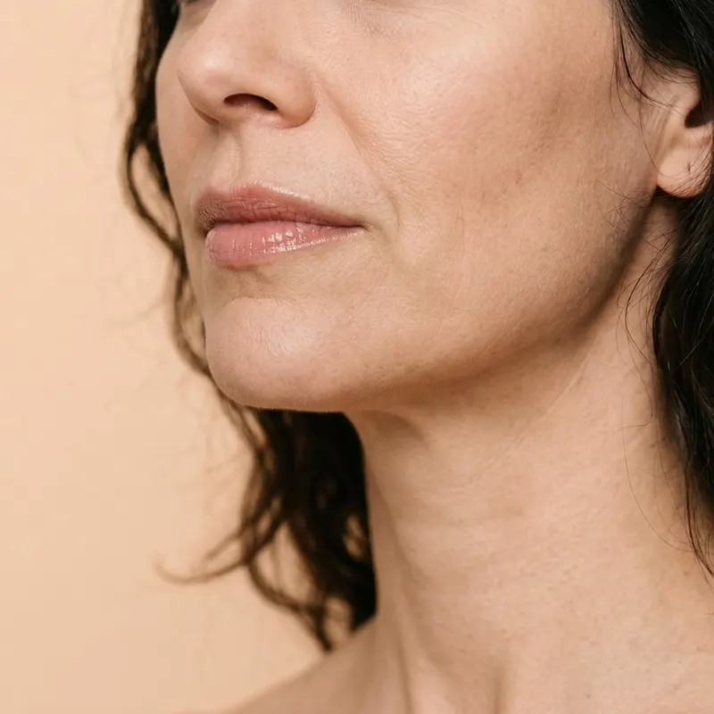 Illustrative after image: smoother, more even skin after a light peel series